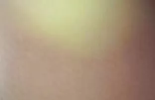 Kate Anh đến được một lớn. Cô là một người đẹp mắt xanh đẹp. Kate cởi quần áo và tiếp xúc của mình to đến sexy gái. Lây lan ra trên ghế chơi trò đó ngọt ngào. Chris đã gia nhập dự tiệc, và ông miệng. Ông nhai nó lên và sau đó từ từ đưa tinh ranh của mình trong cái lỗ đít. Kate đã phá vỡ âm hộ của mình sex tuyen chon hay nhat và sau đó đổ này nước người đàn ông với bộ ngực đẹp, đẹp mặt.